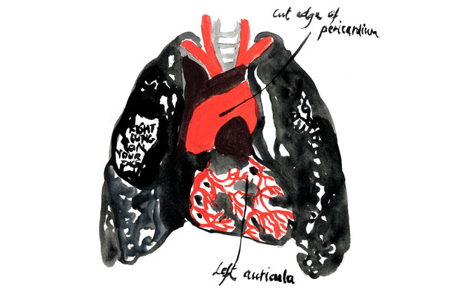 air-bag.jpg